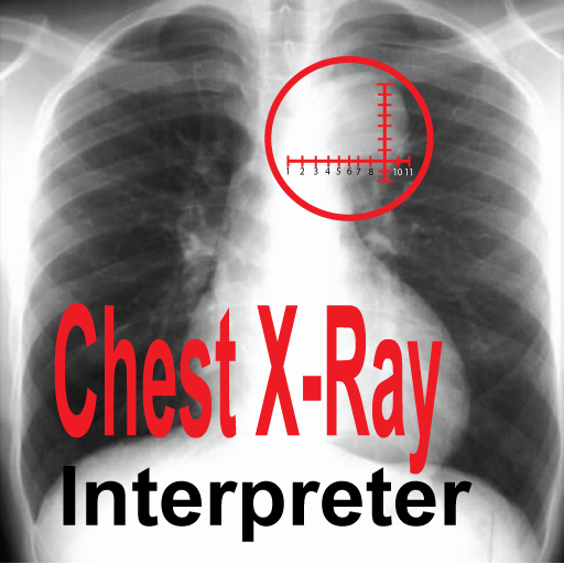 Chest X-Ray Interpreter