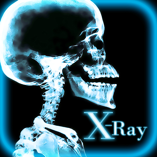X-Ray Cams Pro