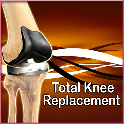 Total Knee Replacement Exercises