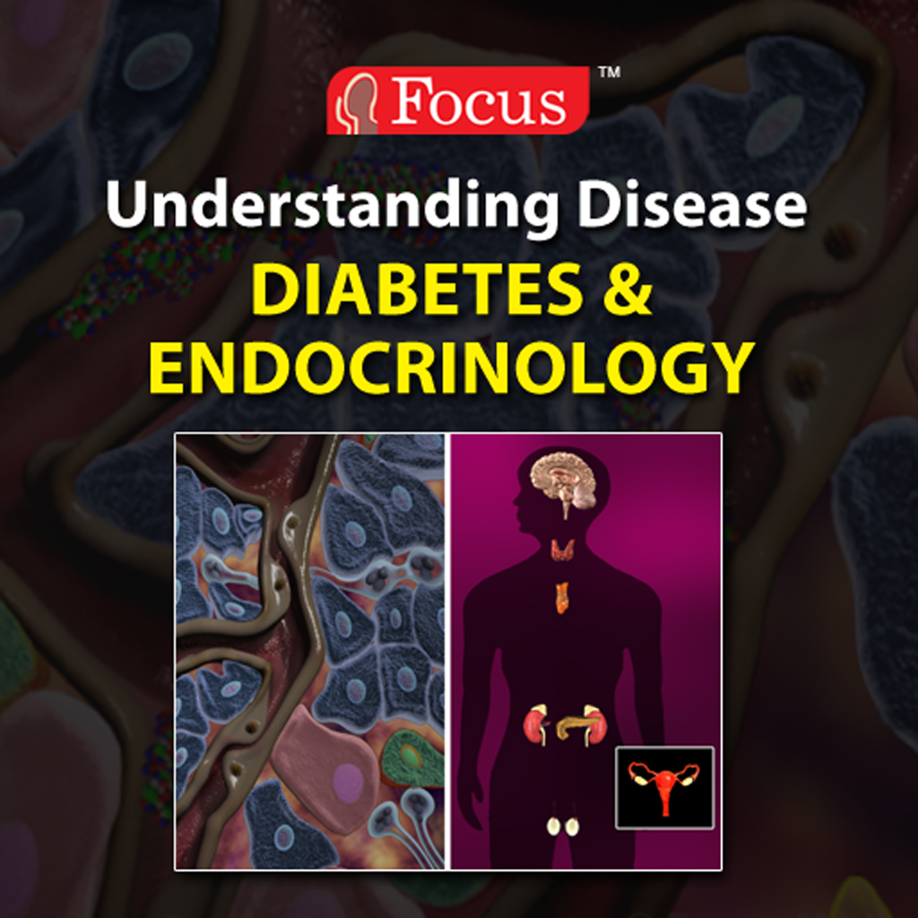 Diabetes & Endocrinology (Understanding Disease Series)