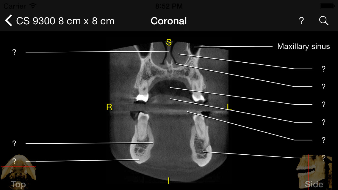 App Shopper CBCT (Medical)