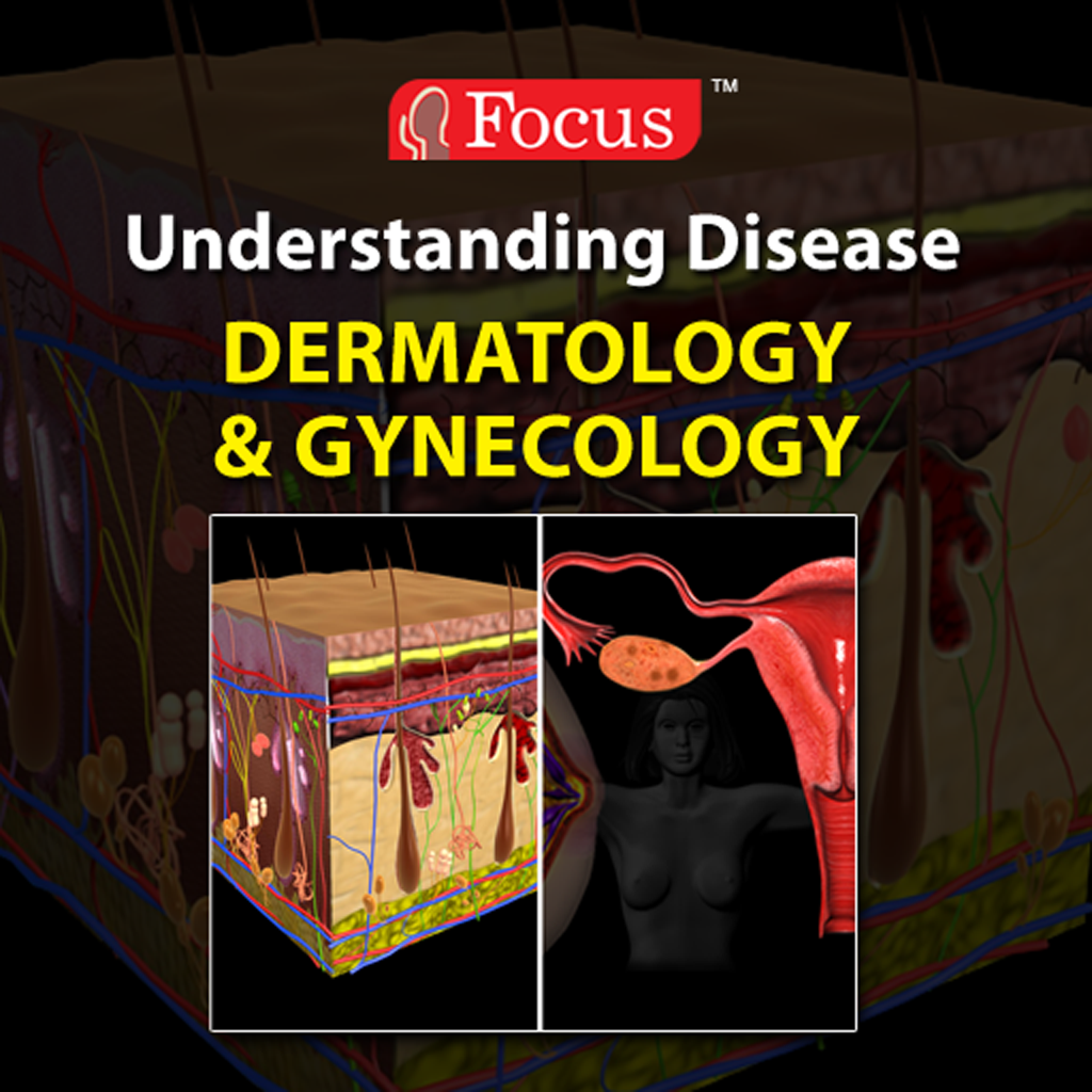 Dermatology, Gynecology (Understanding Disease series)