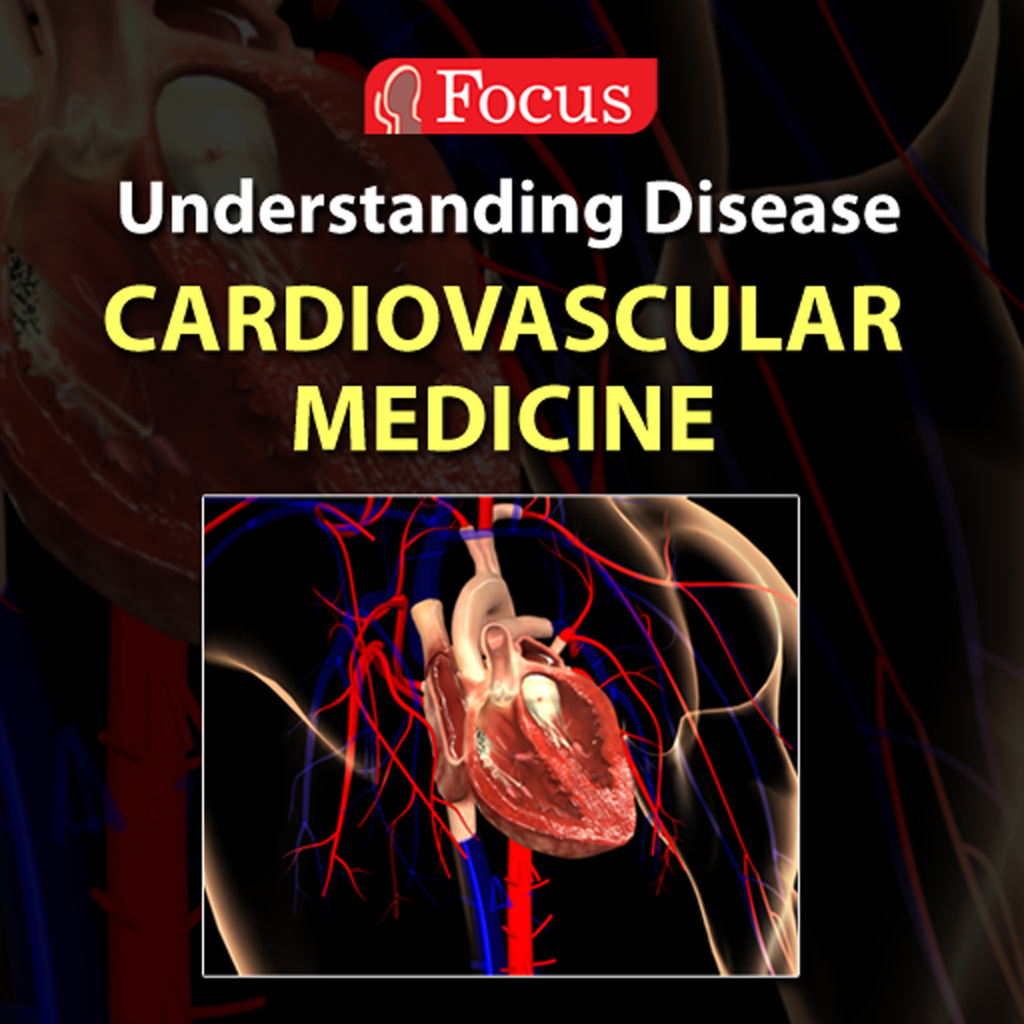 Cardiovascular Medicine (Understanding Disease Series) Focus Apps